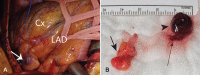 Figure 3)