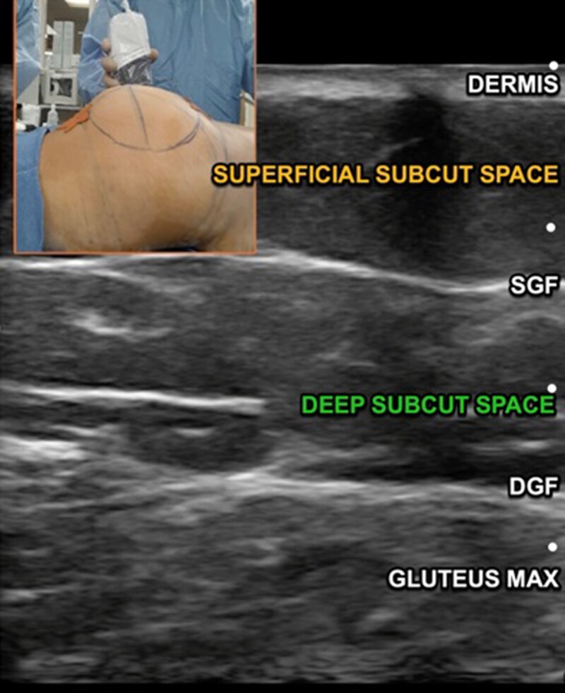 Figure 12.