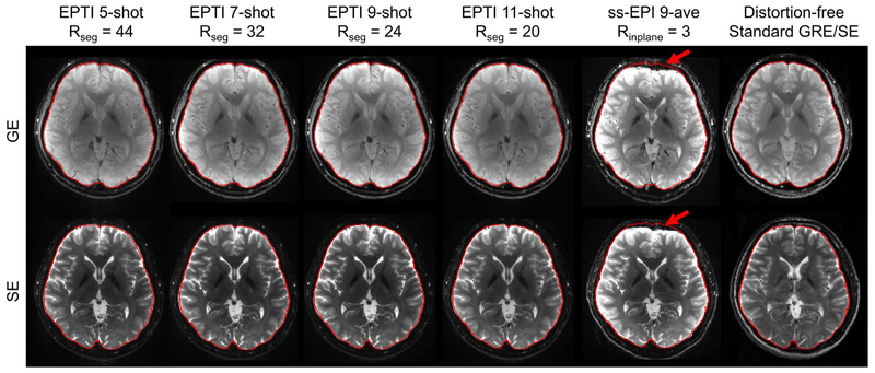 FIG. 6.