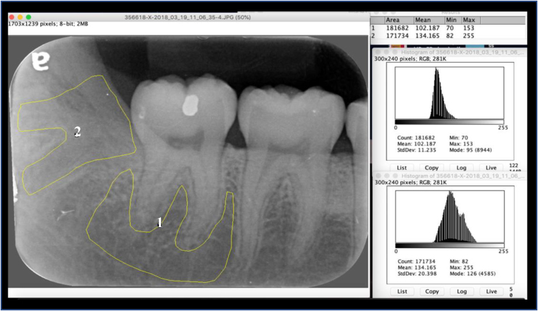 Figure 3