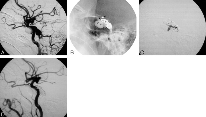 Fig 1.