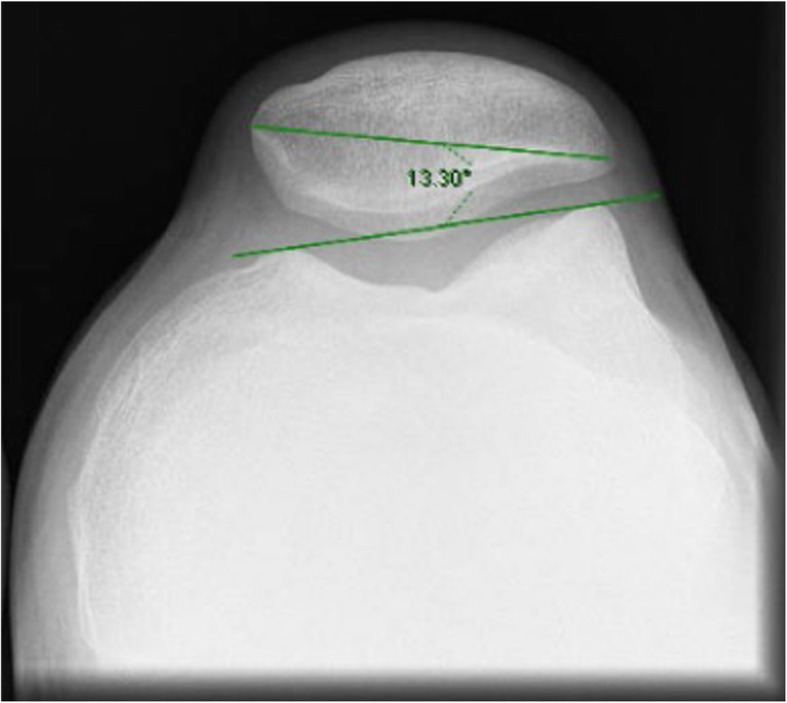 Fig. 2