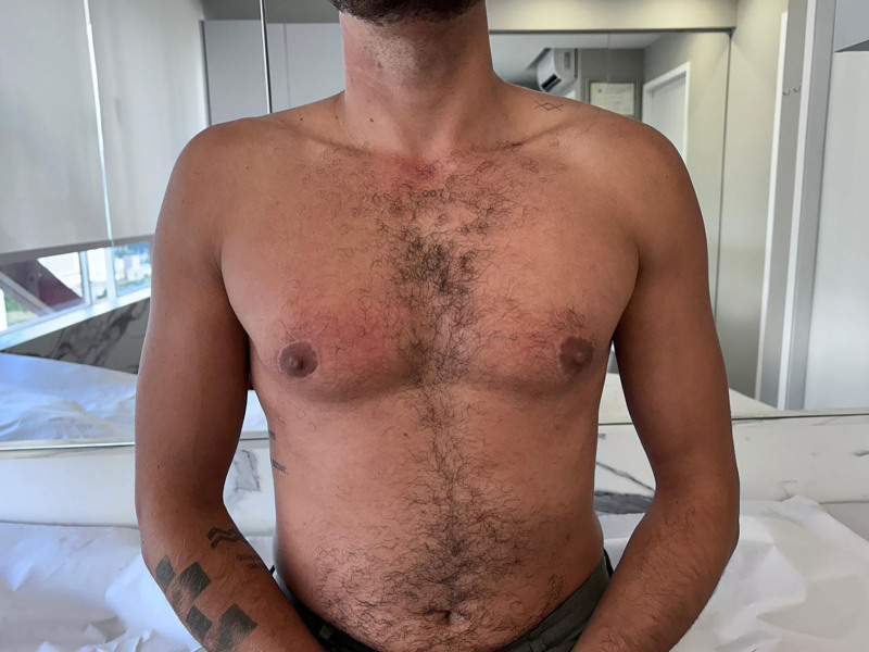 Fig. 10.