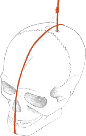 Fig. 5