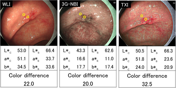 FIGURE 6