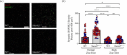 Immunohistochemical analysis of SHANK3 expression in WT and Shank2−/− mice