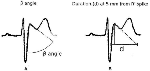 Figure 12