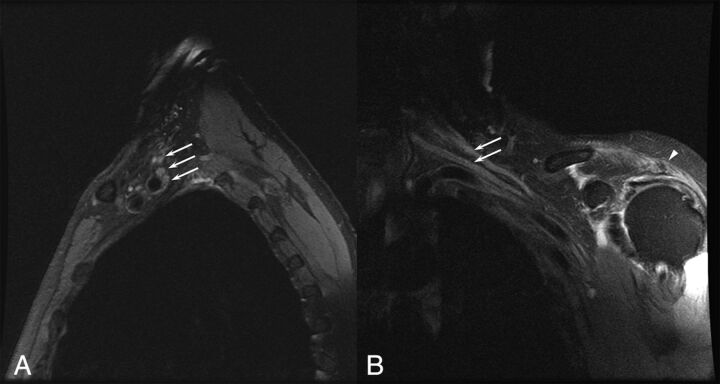 Fig 3.