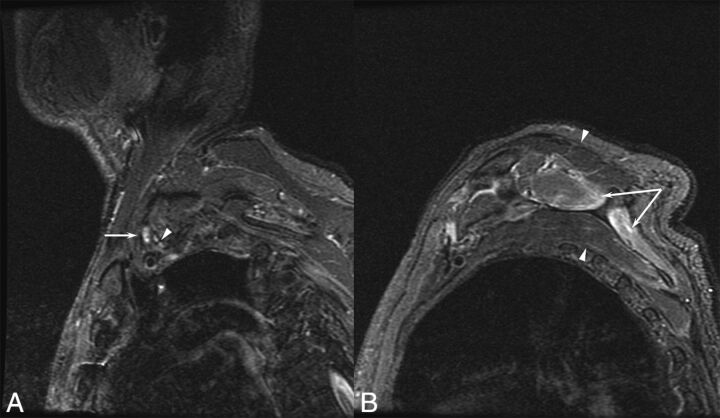 Fig 1.