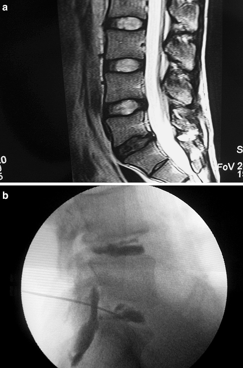 Fig. 1