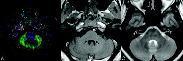 Fig 2.