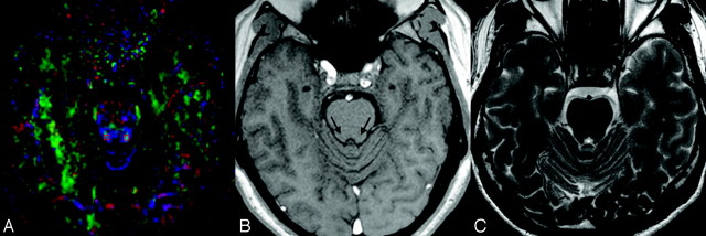 Fig 3.