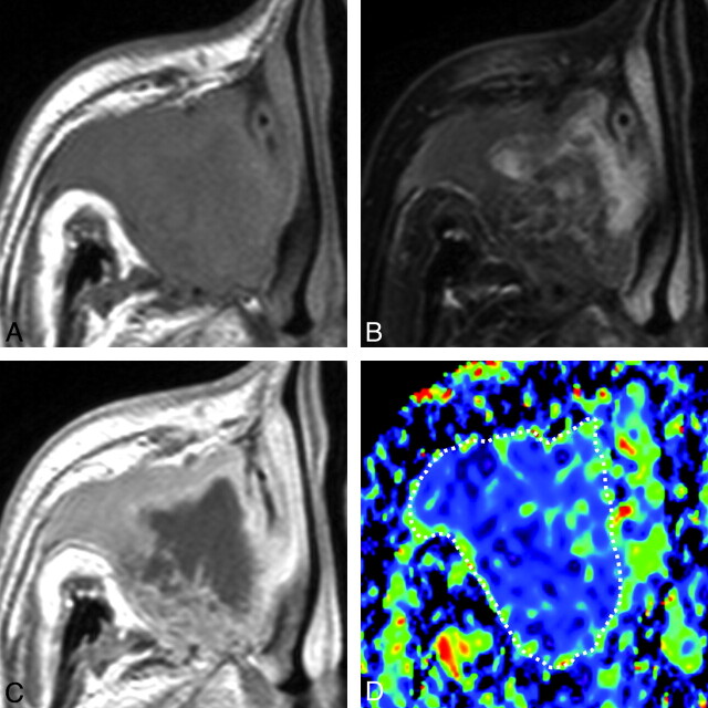 Fig 4.