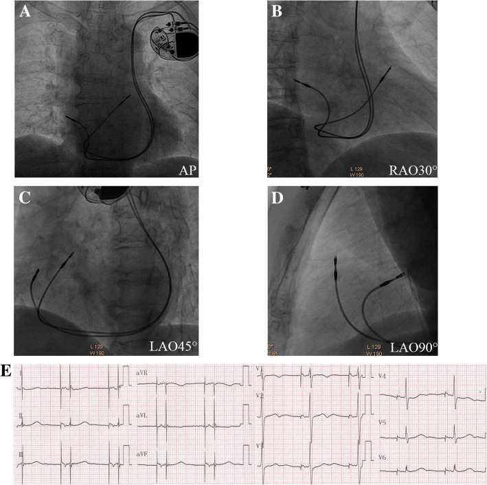 Fig. 3