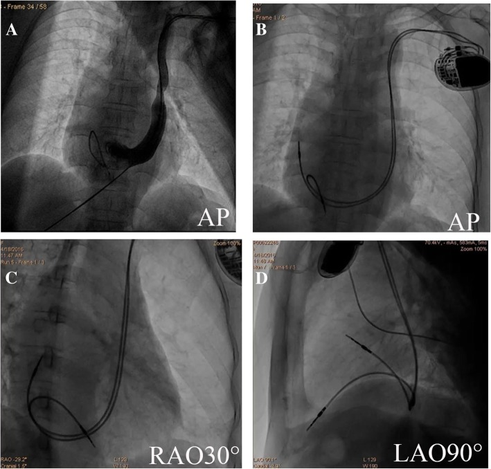 Fig. 2