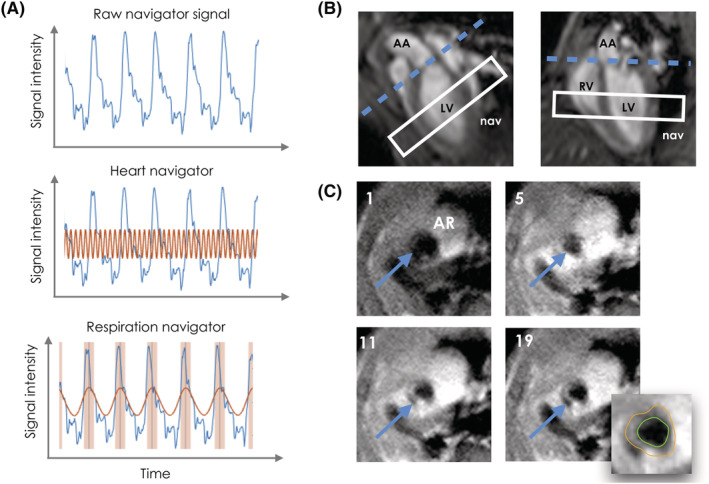 FIGURE 2