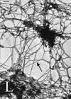 Electron micrographs showing a nucleus with chromatin removed without a prior crosslinking step, revealing a network of branched 10nm filaments.