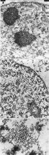 Electron micrographic comparison showing that the distribution of RNA, as detected by EDTA regressive staining is conserved after the removal of chromatin.