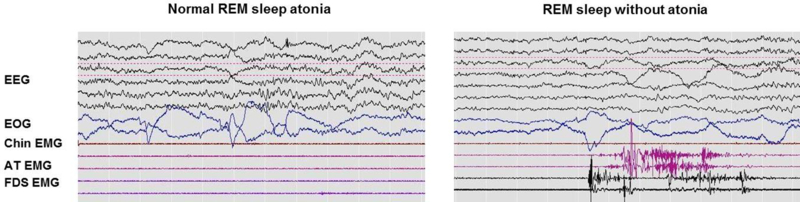 Figure 3: