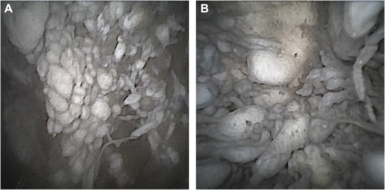 Figure 3