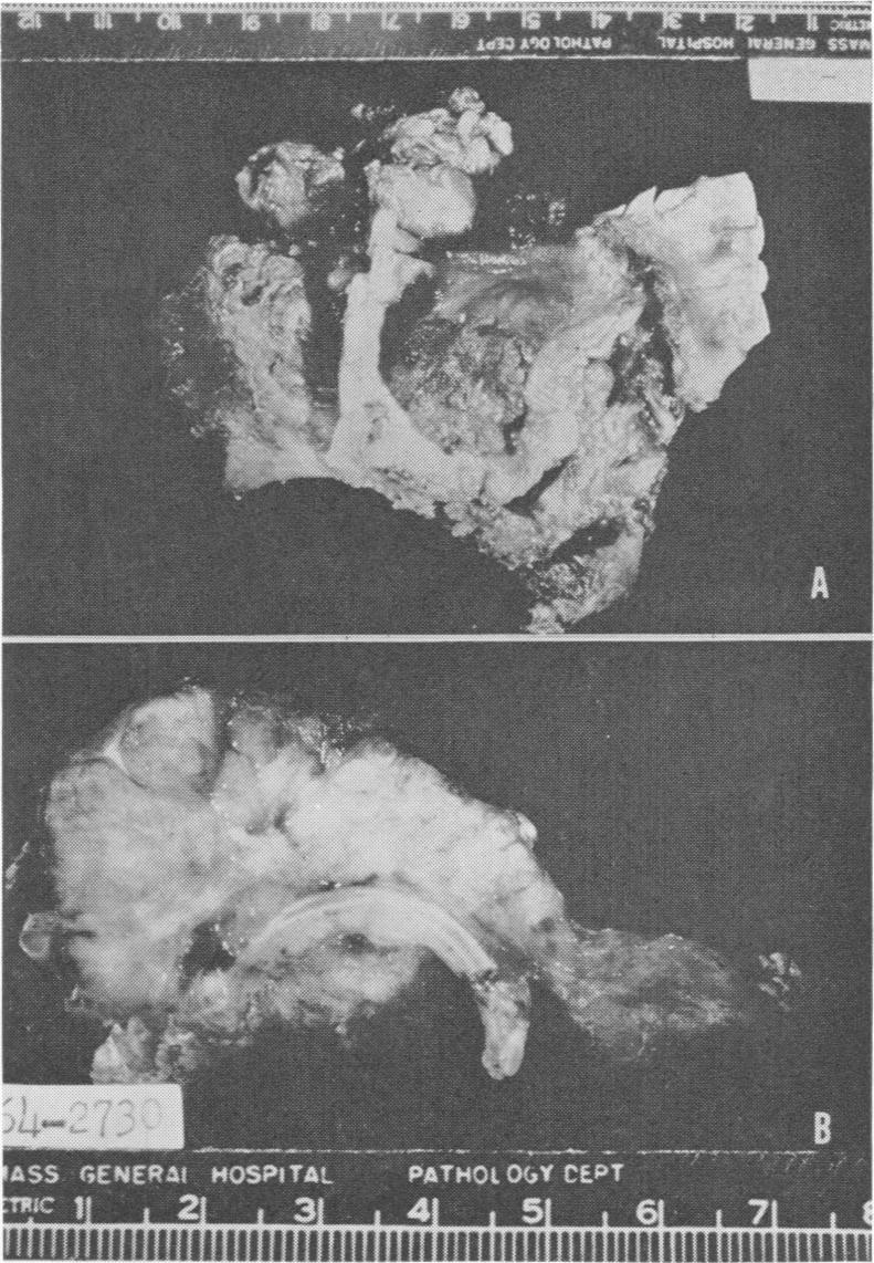 Fig. 6. Case 5.