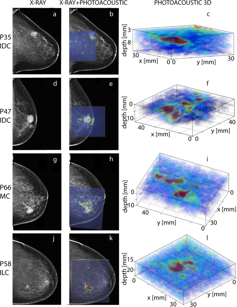 Fig. 4