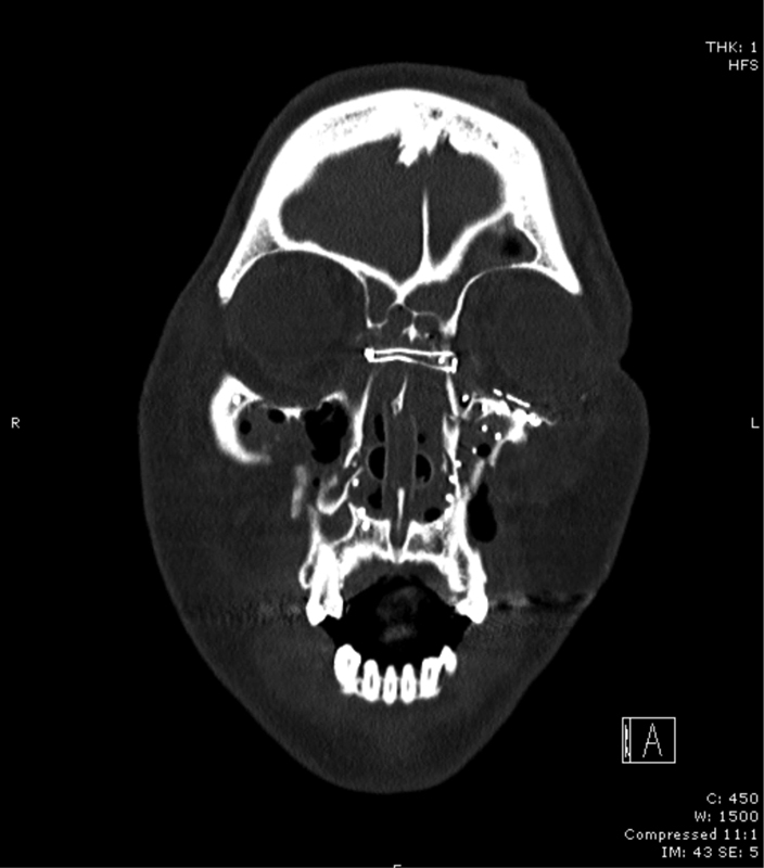 Fig. 9