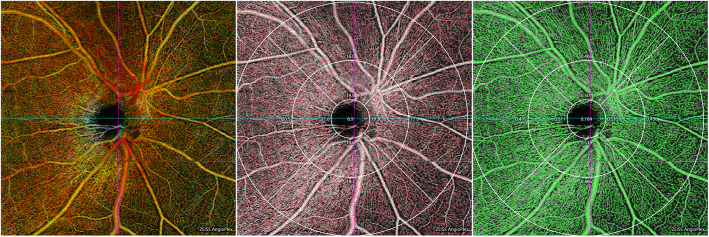 Fig. 2