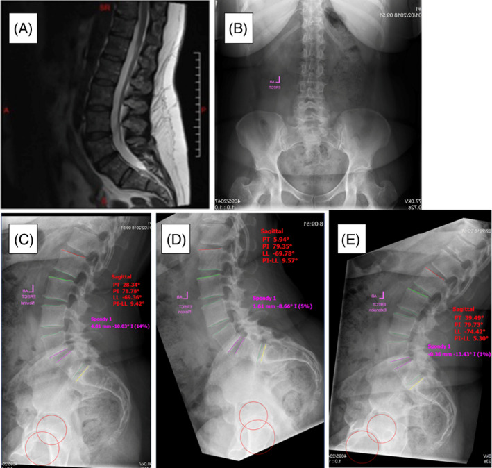 FIGURE 4