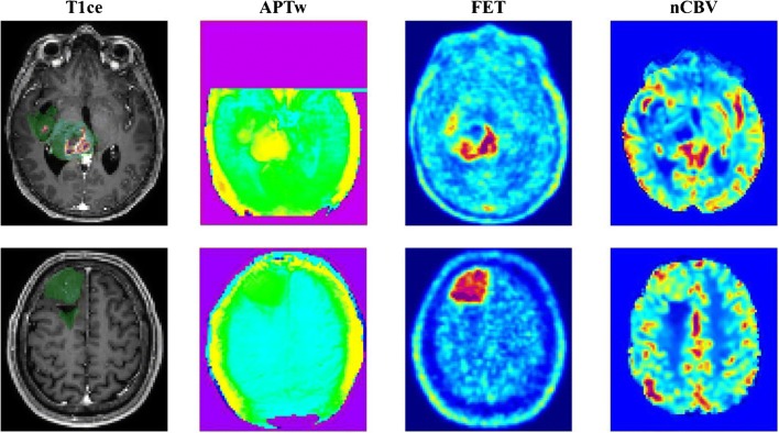 Fig. 2