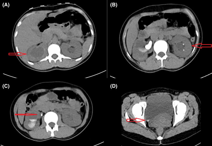 FIGURE 1