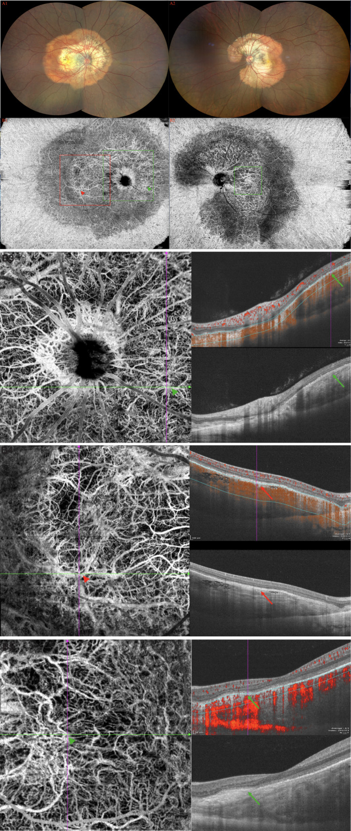 Figure 3