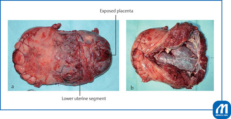 Fig. 11