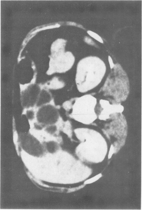 Fig. 7B.