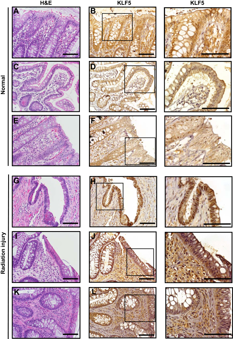 Figure 12