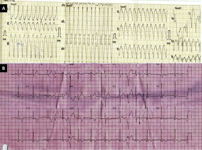 Fig. 1