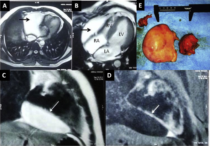 Fig. 2