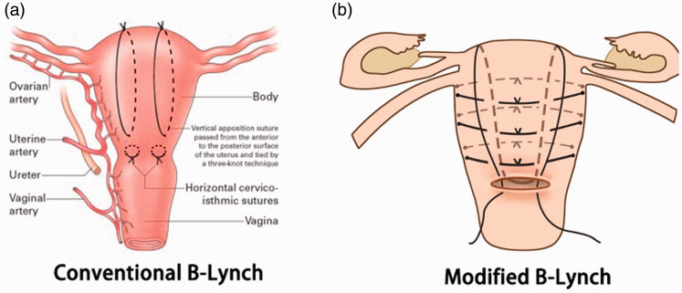 Appendix Figure 2.