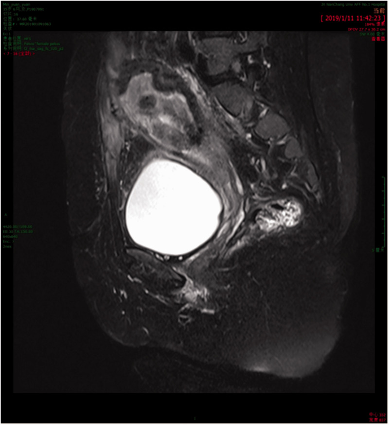 Appendix Figure 1.