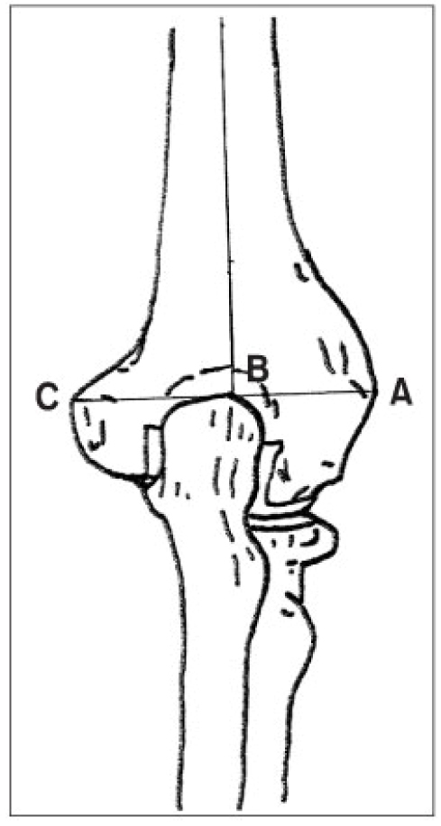 [Table/Fig-4]: