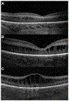 Fig. 11.