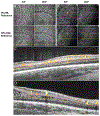 Fig. 15.