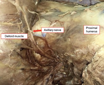 Fig. 2: