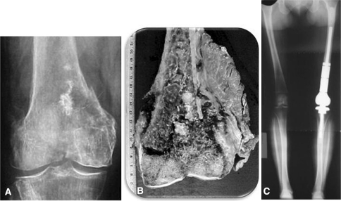 Fig. 4A–C