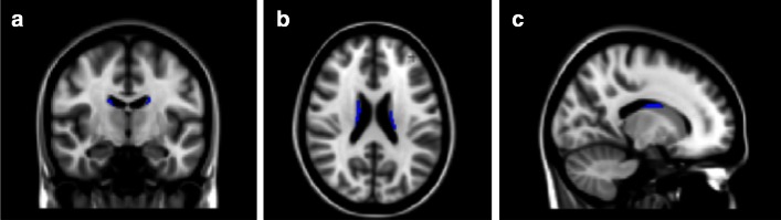 Fig. 1