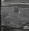 Figure 21