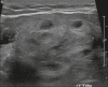 Figure 20