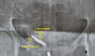 Fig. 1a.
