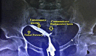 Fig. 1b.