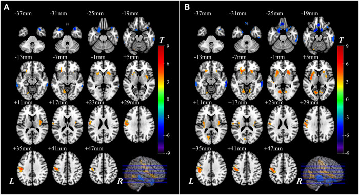 FIGURE 3